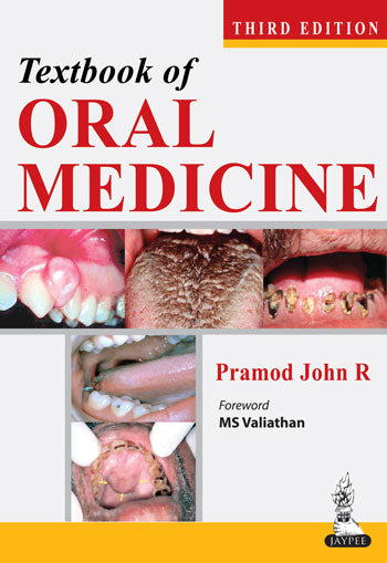 TEXTBOOK OF ORAL MEDICINE