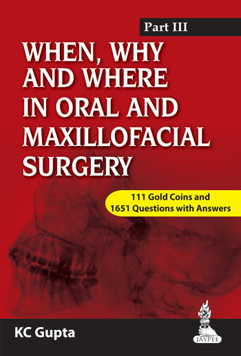 WHEN,WHY AND WHERE IN ORAL AND MAXILLOFACIAL SURGERY PART III