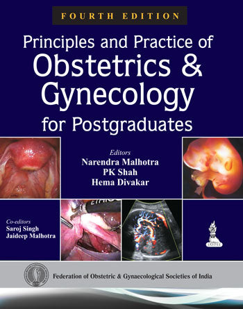 PRINCIPLES AND PRACTICE OF OBSTETRICS AND GYNECOLOGY FOR POSTGRADUATES