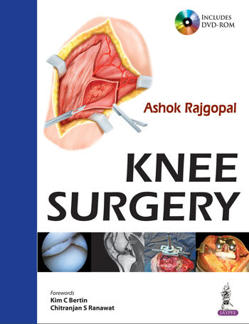 KNEE SURGERY INCLUDES DVD-ROM