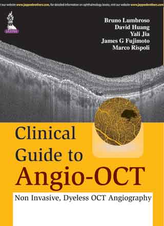 CLINICAL GUIDE TO ANGIO-OCT: NON INVASIVE,DYELESS OCT ANGIOGRAPHY