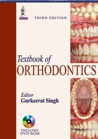 TEXTBOOK OF ORTHODONTICS