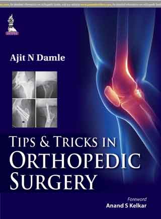 TIP & TRICKS IN ORTHOPEDIC SURGERY