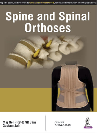 SPINE AND SPINAL ORTHOSES