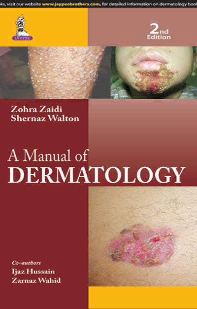 A MANUAL OF DERMATOLOGY