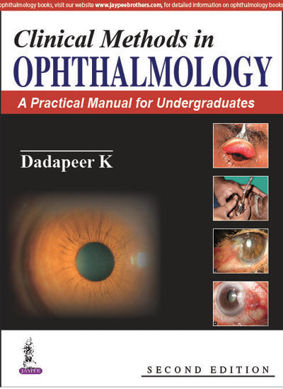 CLINICAL METHODS IN OPHTHALMOLOGY:A PRACTICAL MANUAL FOR UNDERGRADUATES
