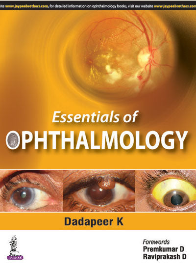 ESSENTIALS OF OPHTHALMOLOGY