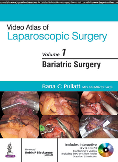 VIDEO ATLAS OF LAPAROSCOPIC SURGERY VOL.1 BARIATRIC SURGERY WITH DVD-ROM