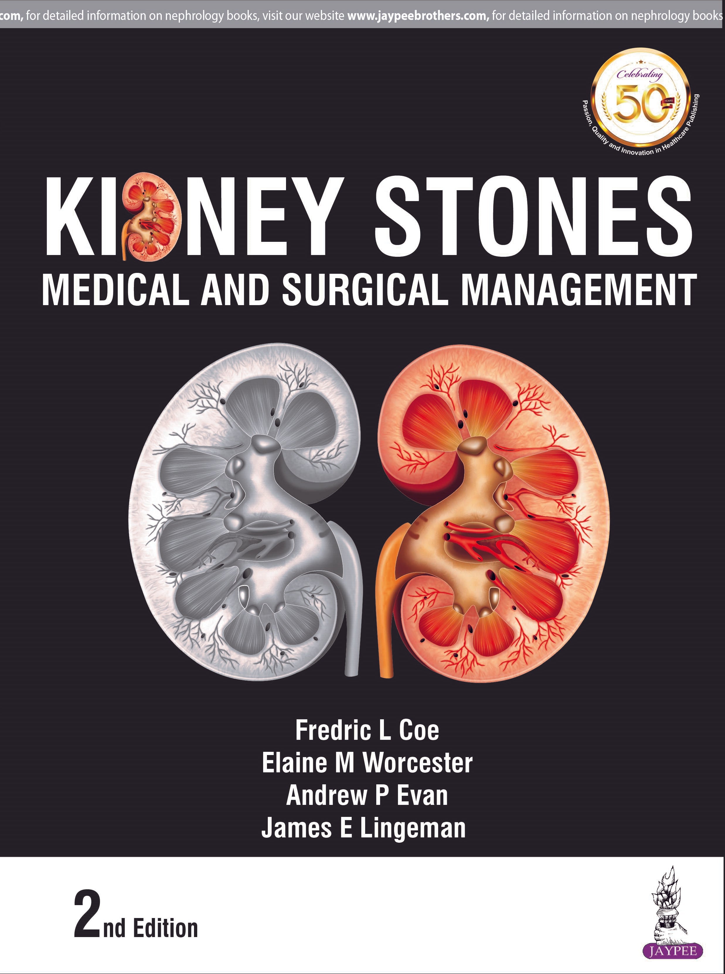 KIDNEY STONES: MEDICAL AND SURGICAL MANAGEMENT