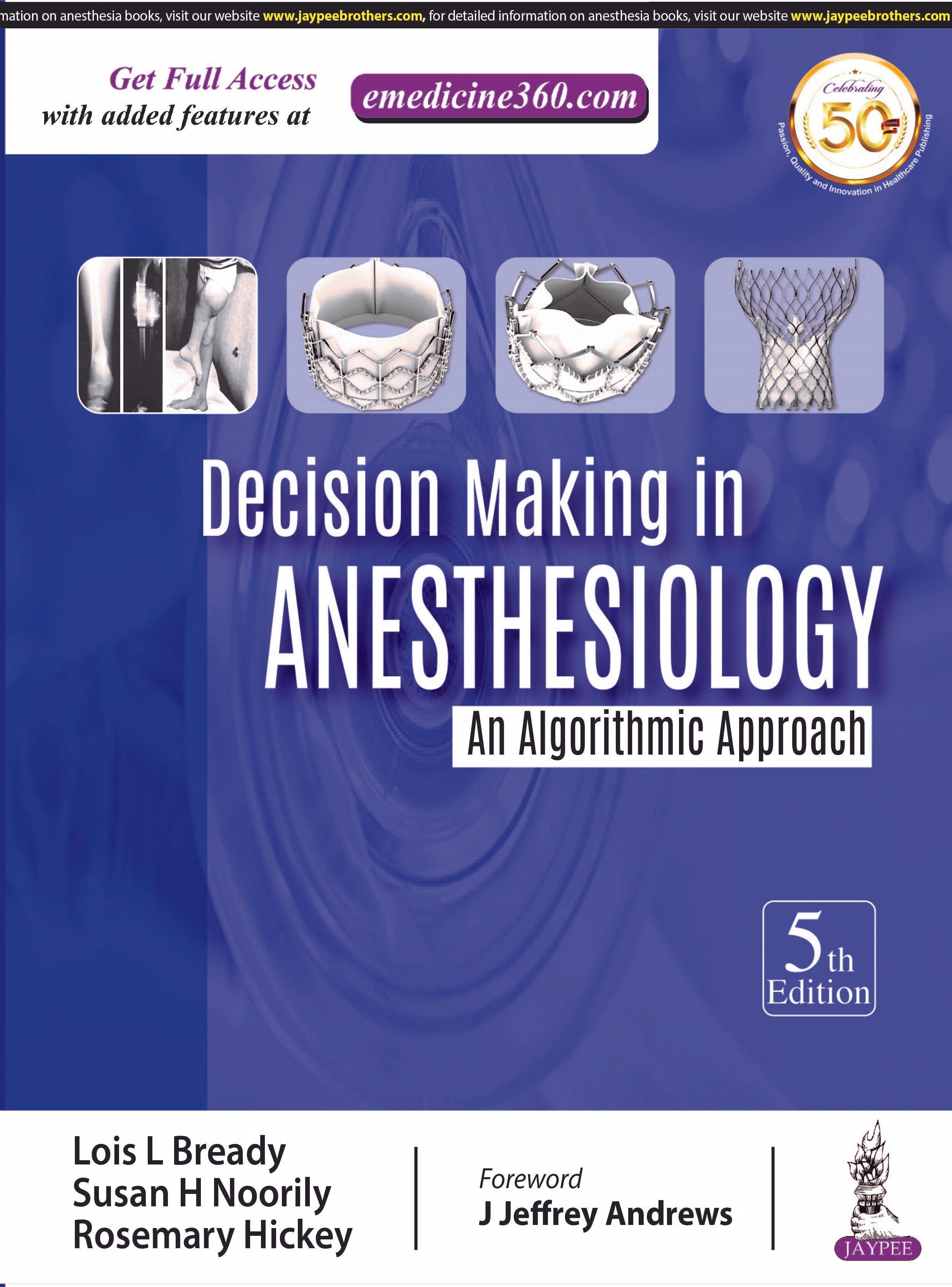 DECISION MAKING IN ANESTHESIOLOGY: AN ALGORITHMIC APPROACH