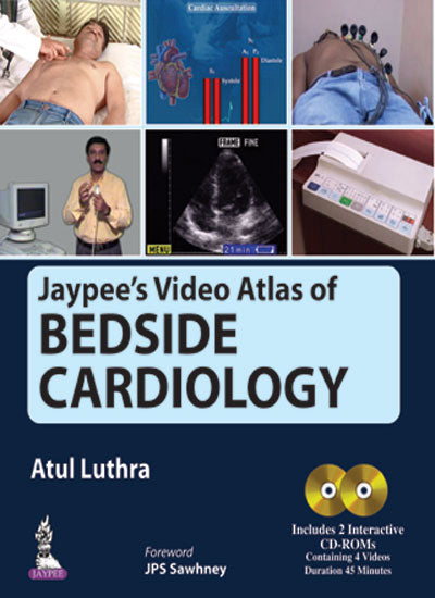 JAYPEE'S VIDEO ATLAS OF BEDSIDE CARDIOLOGY INCLUDES 2 INTERACTIVE CD-ROMS