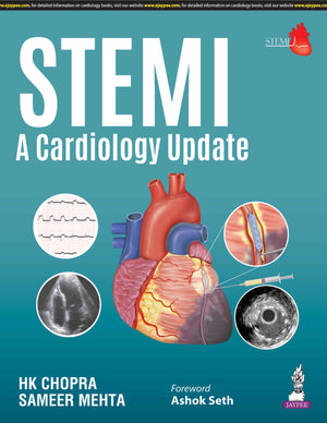 STEMI: A Cardiology Update