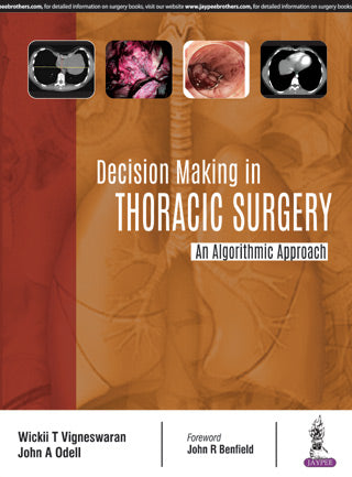 DECISION MAKING IN THORACIC SURGERY AN ALGORITHMIC APPROACH
