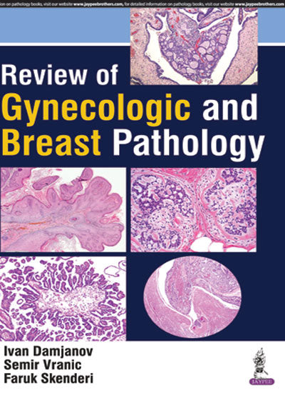 REVIEW OF GYNECOLOGIC AND BREAST PATHOLOGY