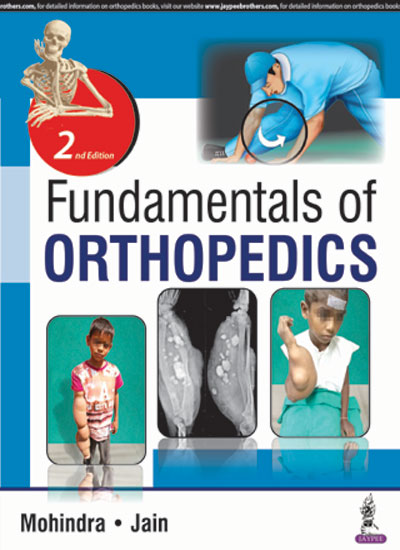 FUNDAMENTALS OF ORTHOPEDICS