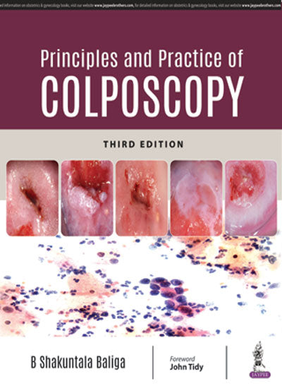 PRINCIPLES AND PRACTICE OF COLPOSCOPY