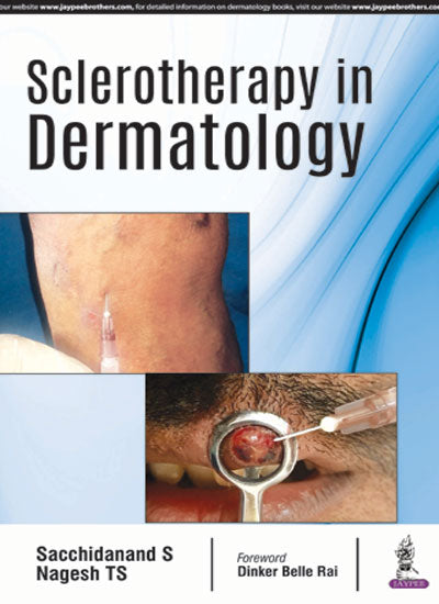 SCLEROTHERAPY IN DERMATOLOGY