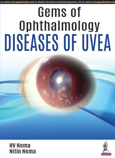 GEMS OF OPHTHALMOLOGY:DISEASES OF UVEA