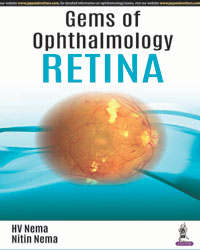 GEMS OF OPHTHALMOLOGY RETINA