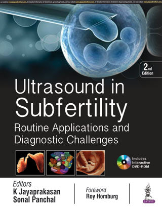 ULTRASOUND IN SUBFERTILITY ROUTINE APPLICATION