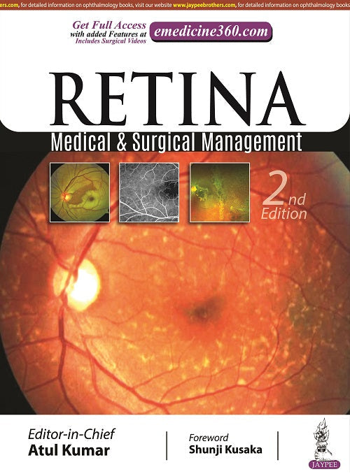 RETINA: MEDICAL & SURGICAL MANAGEMENT