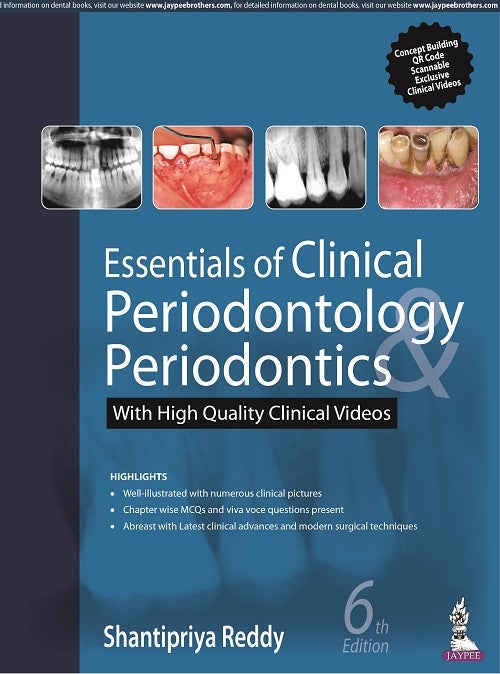 ESSENTIALS OF CLINICAL PERIODONTOLOGY & PERIODONTICS WITH HIGH QUALITY CLINICAL VIDEOS