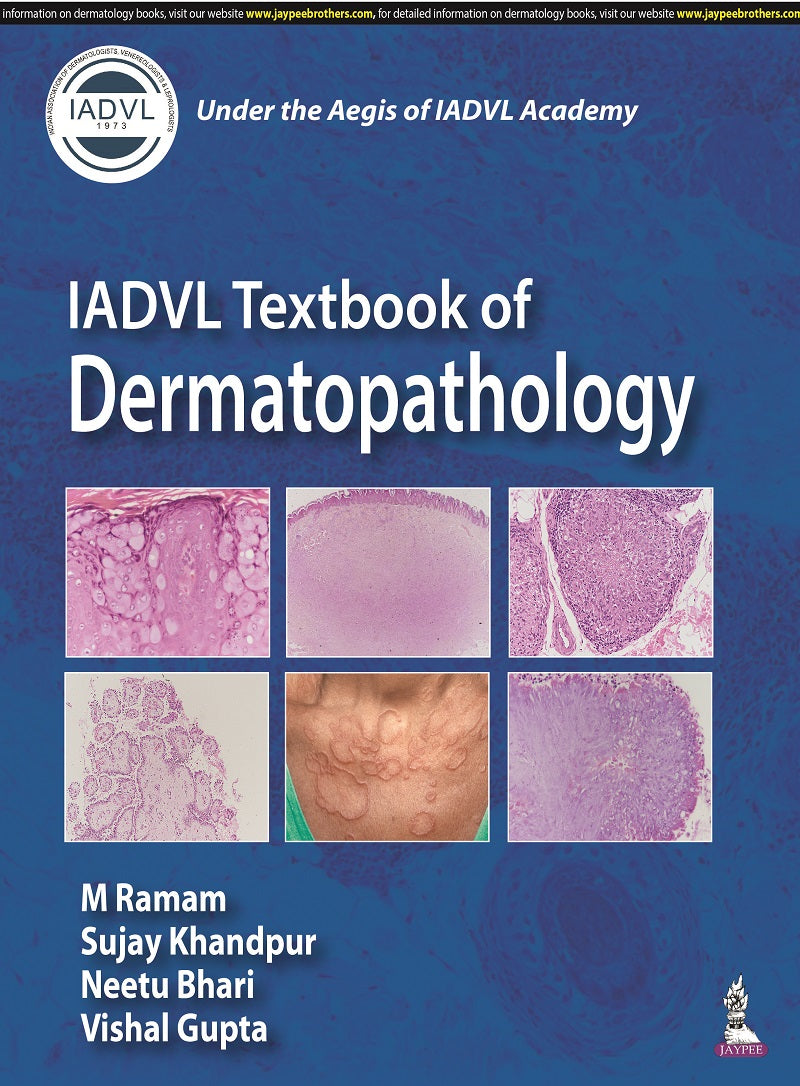 IADVL TEXTBOOK OF DERMATOPATHOLOGY