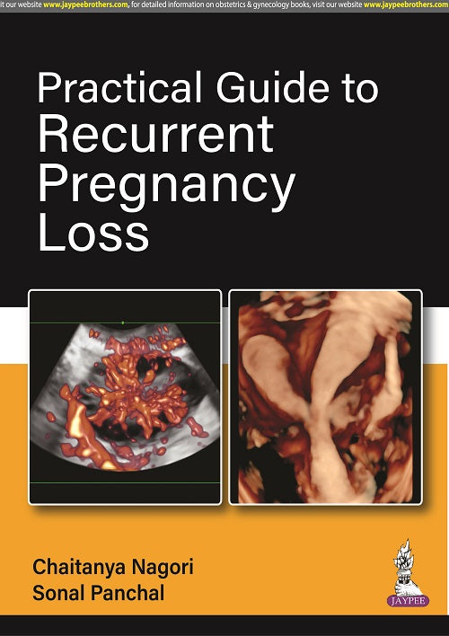 PRACTICAL GUIDE TO RECURRENT PREGNANCY LOSS