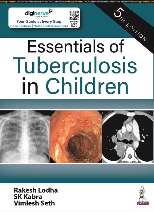 ESSENTIALS OF TUBERCULOSIS IN CHILDREN