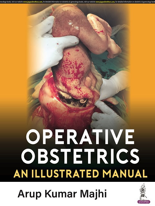 OPERATIVE OBSTETRICS: AN ILLUSTRATED MANUAL