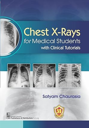 Chest X Rays For Medical Students With Clinical Tutorials (PB)