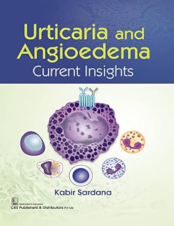 Urticaria And Angioedema Current Insights (PB)