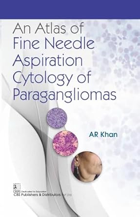 An Atlas of Fine Needle Aspiration Cytology and Paraganglimas (HB)