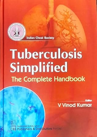 Tuberculosis Simplified The Complete Handbook (HB)