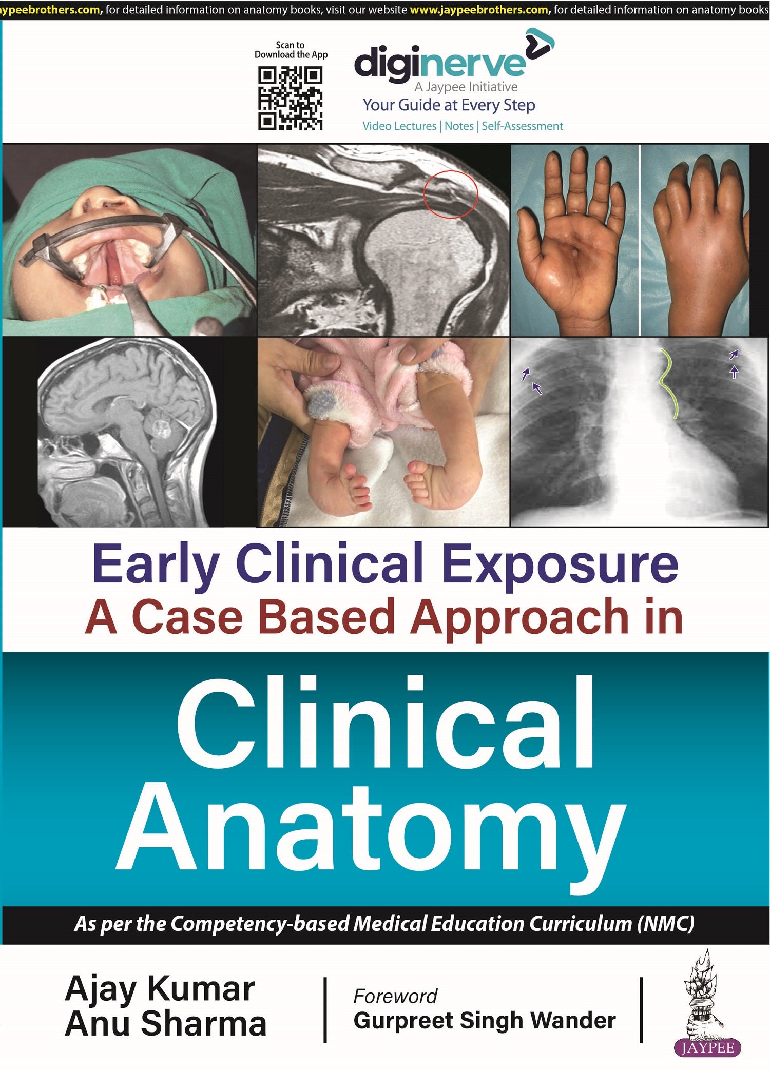 EARLY CLINICAL EXPOSURE: A CASE BASED APPROACH IN CLINICAL ANATOMY