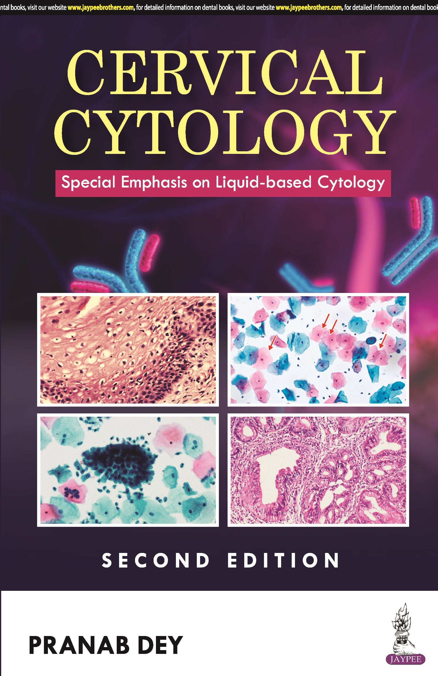 CERVICAL CYTOLOGY: SPECIAL EMPHASIS ON LIQUID-BASED CYTOLOGY