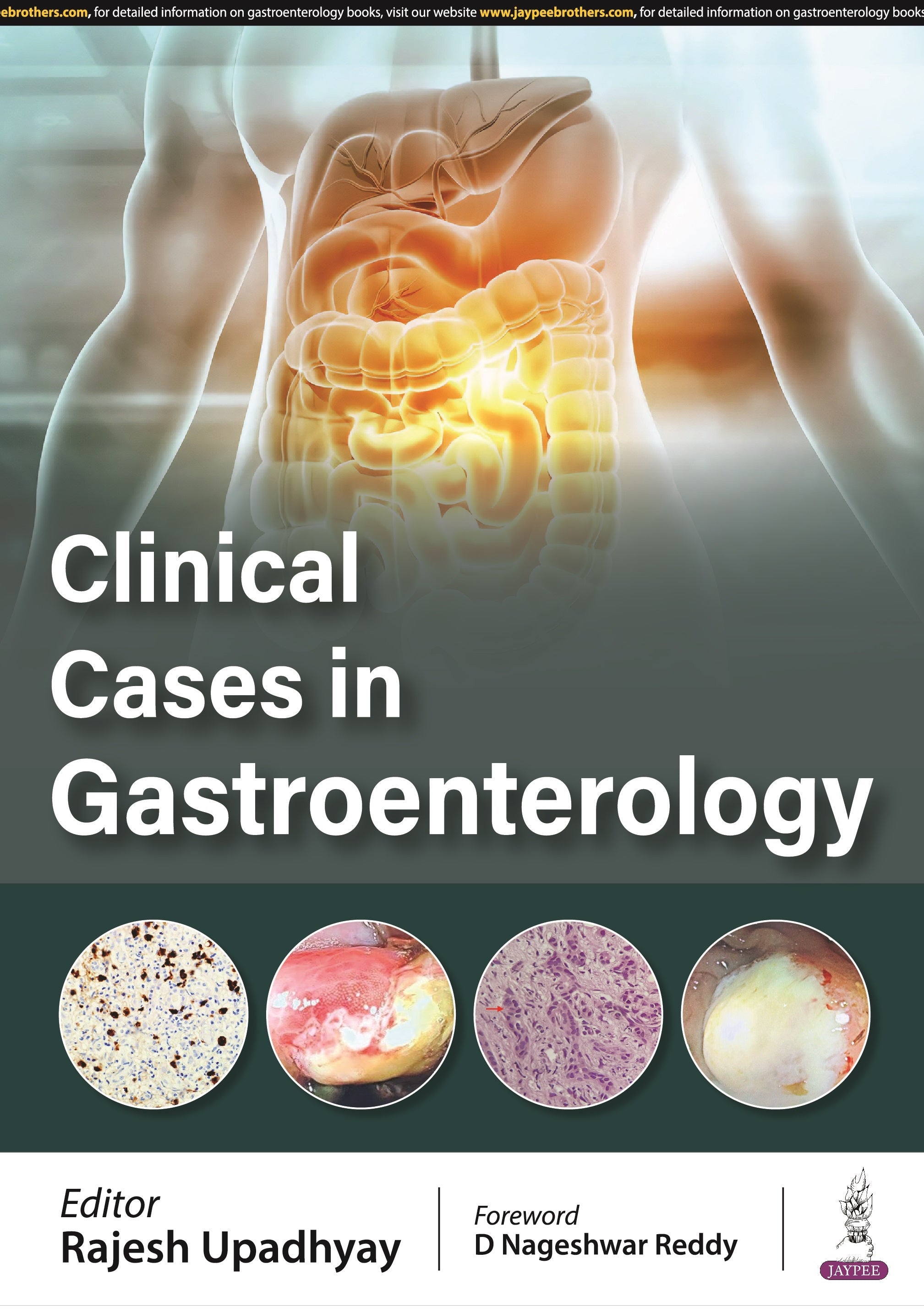 CLINICAL CASES IN GASTROENTEROLOGY