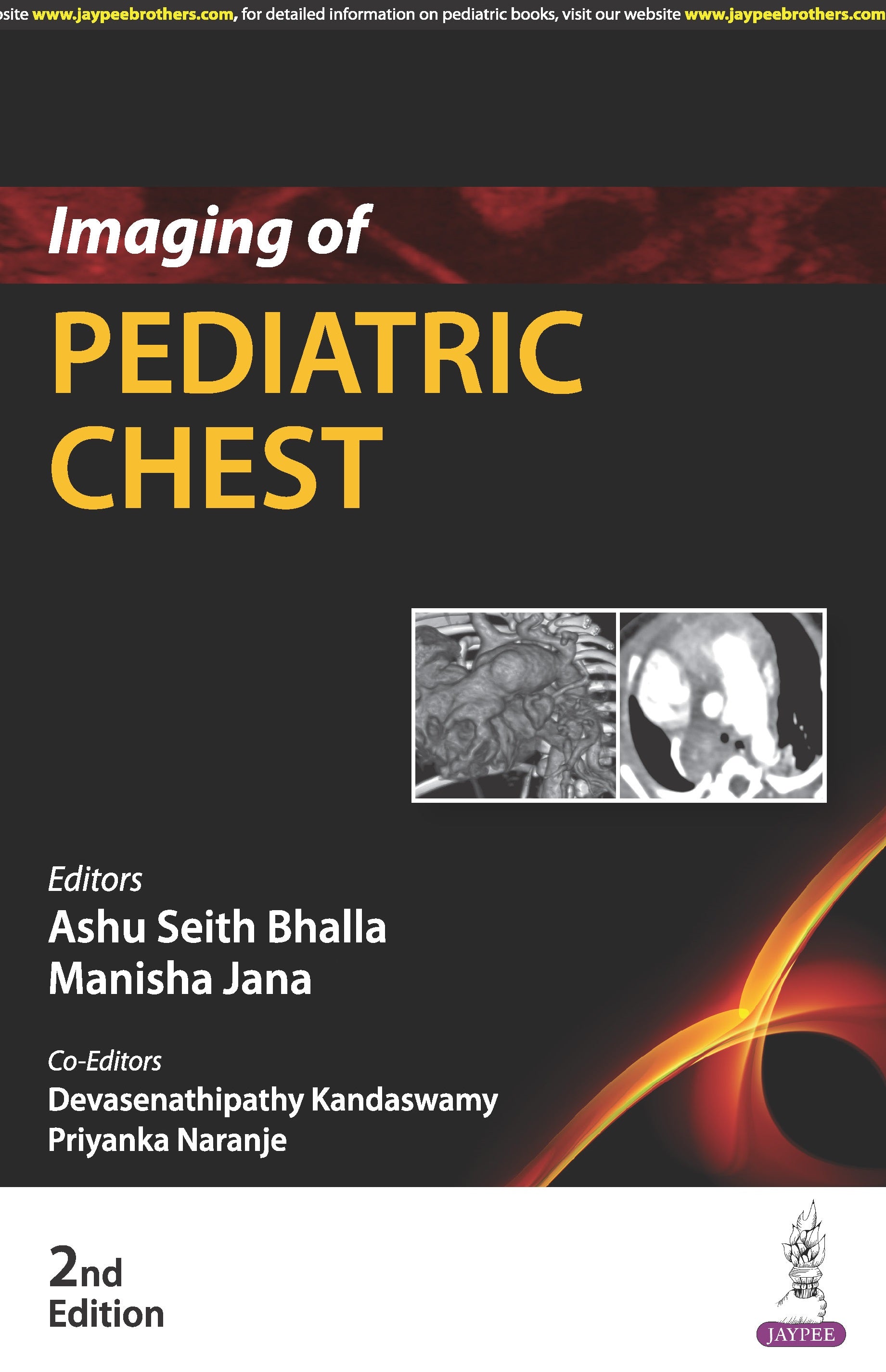 IMAGING OF PEDIATRIC CHEST