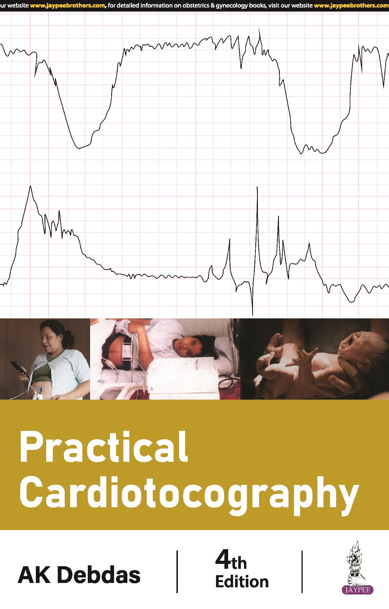 PRACTICAL CARDIOTOCOGRAPHY