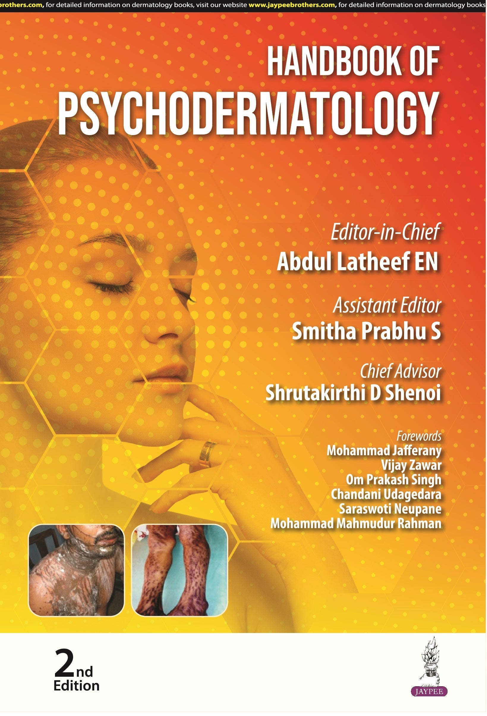 HANDBOOK OF PSYCHODERMATOLOGY