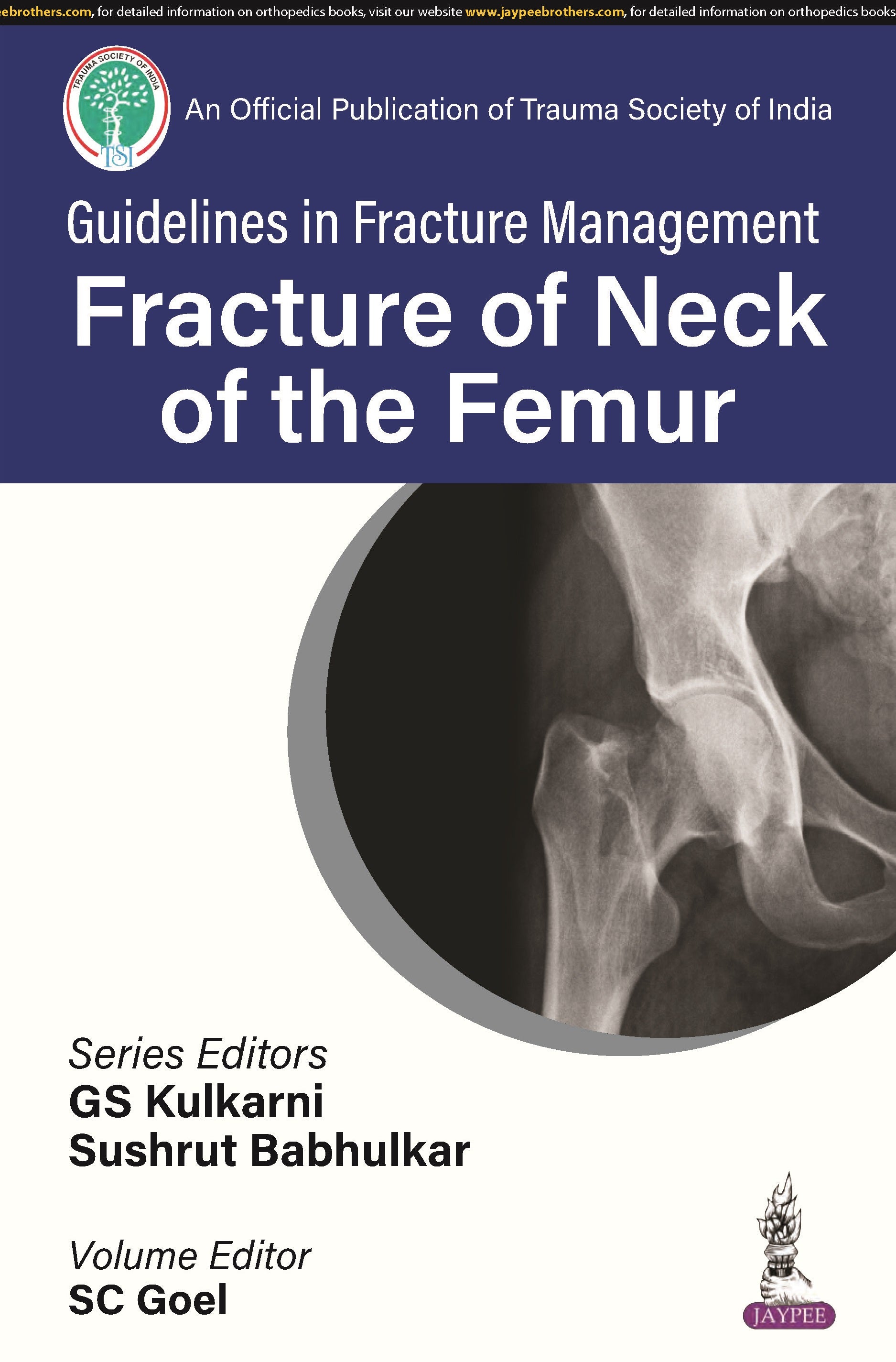 GUIDELINES IN FRACTURE MANAGEMENT FRACTURE OF NECK OF THE FEMUR