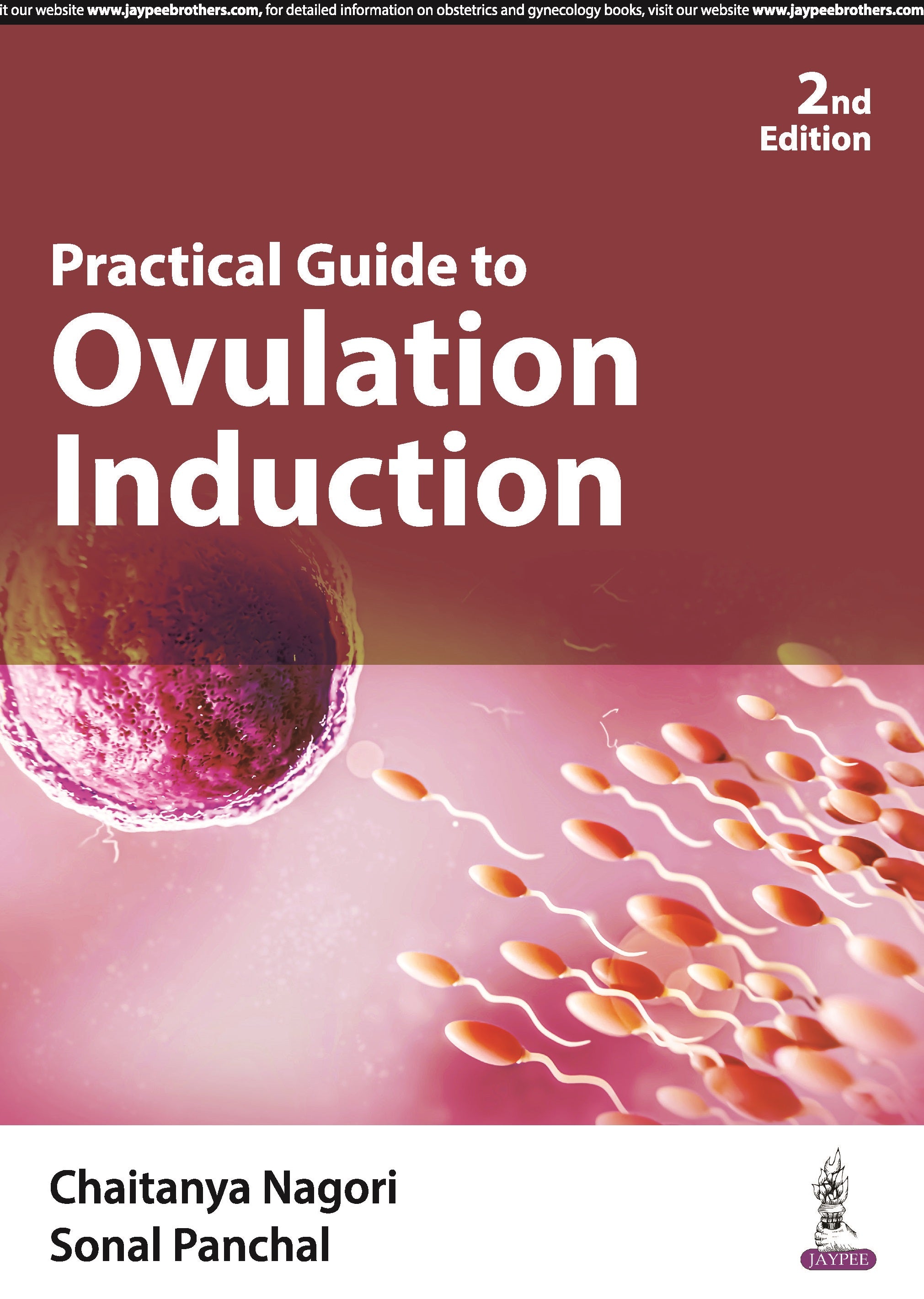 PRACTICAL GUIDE TO OVULATION INDUCTION