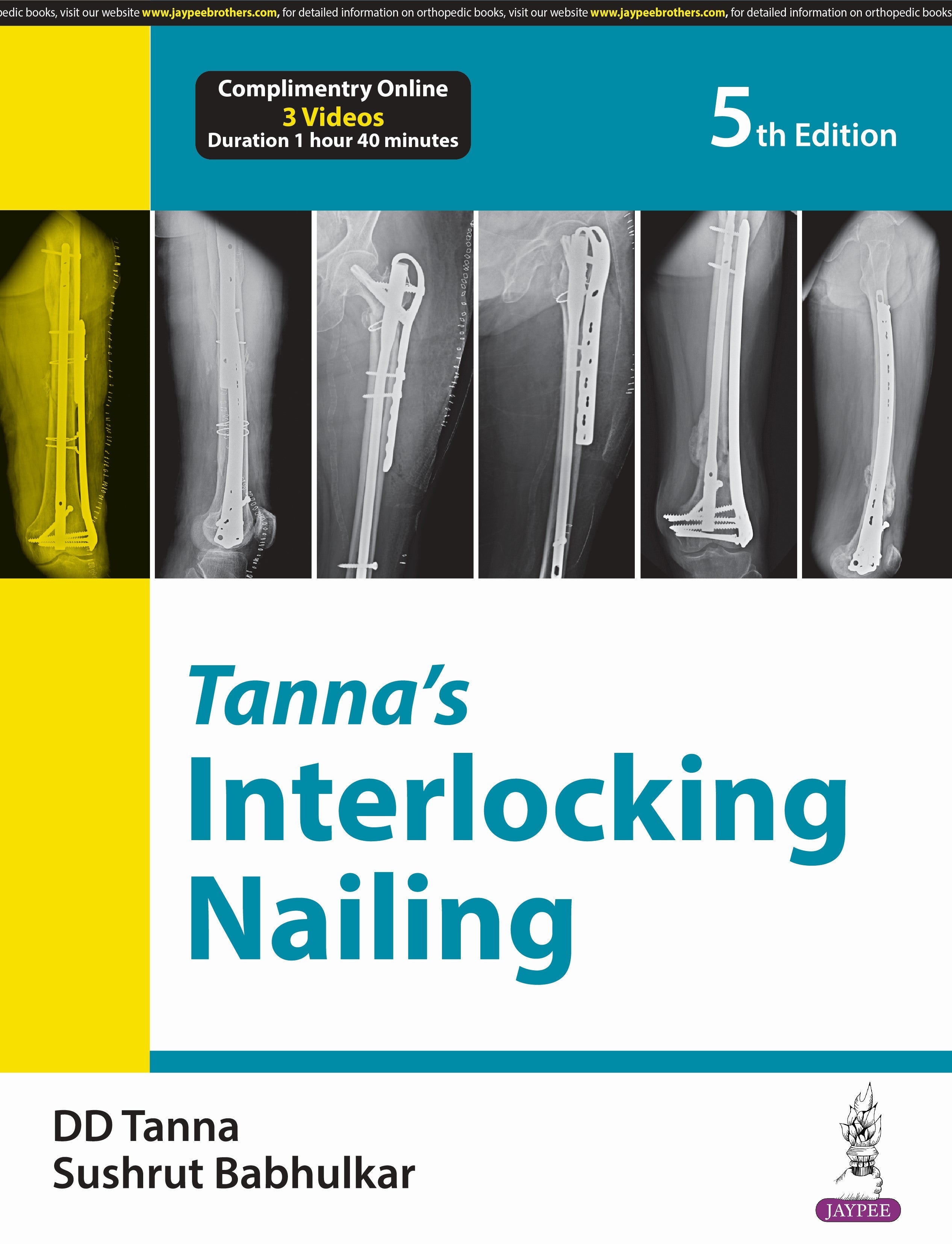 TANNA'S INTERLOCKING NAILING