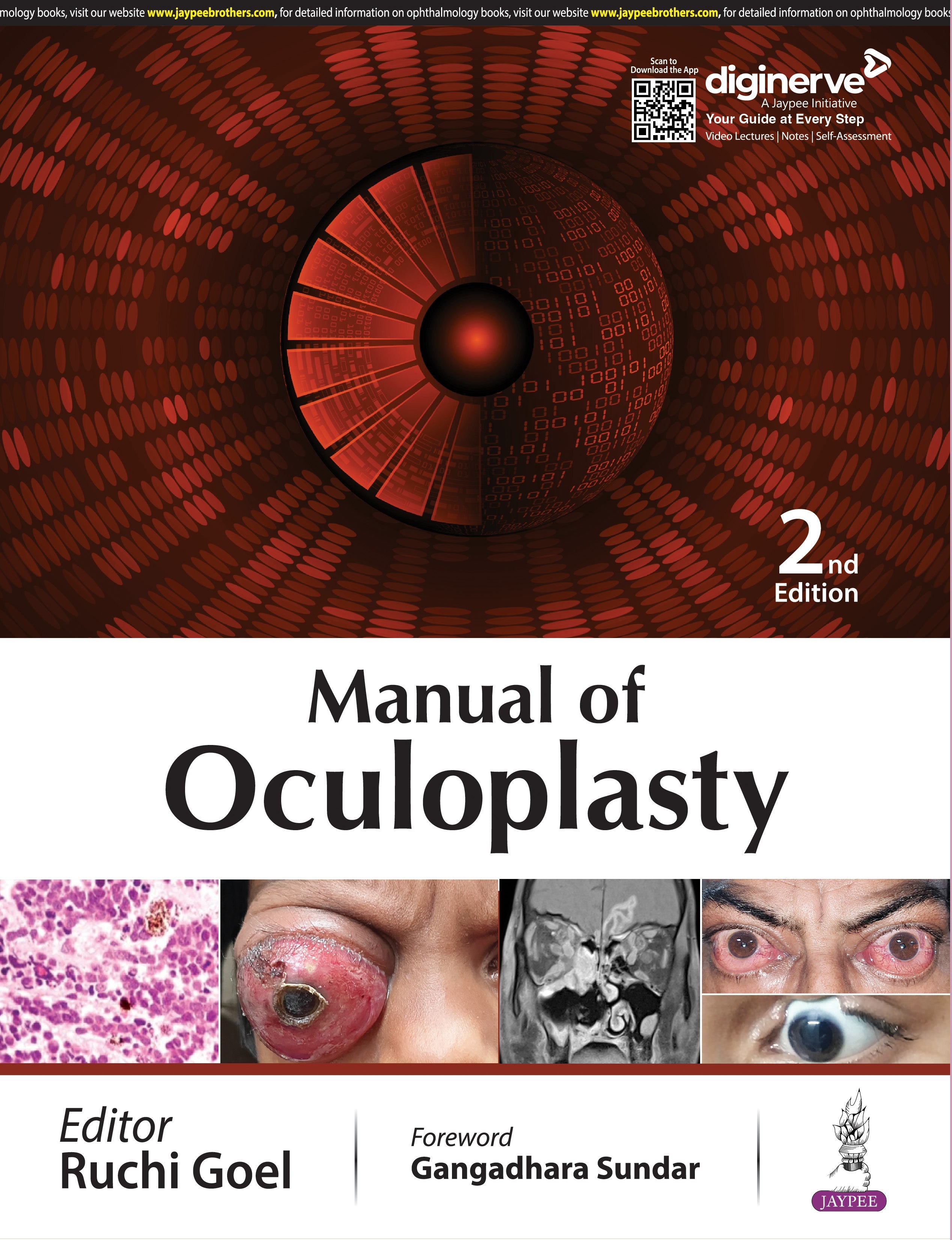 MANUAL OF OCULOPLASTY