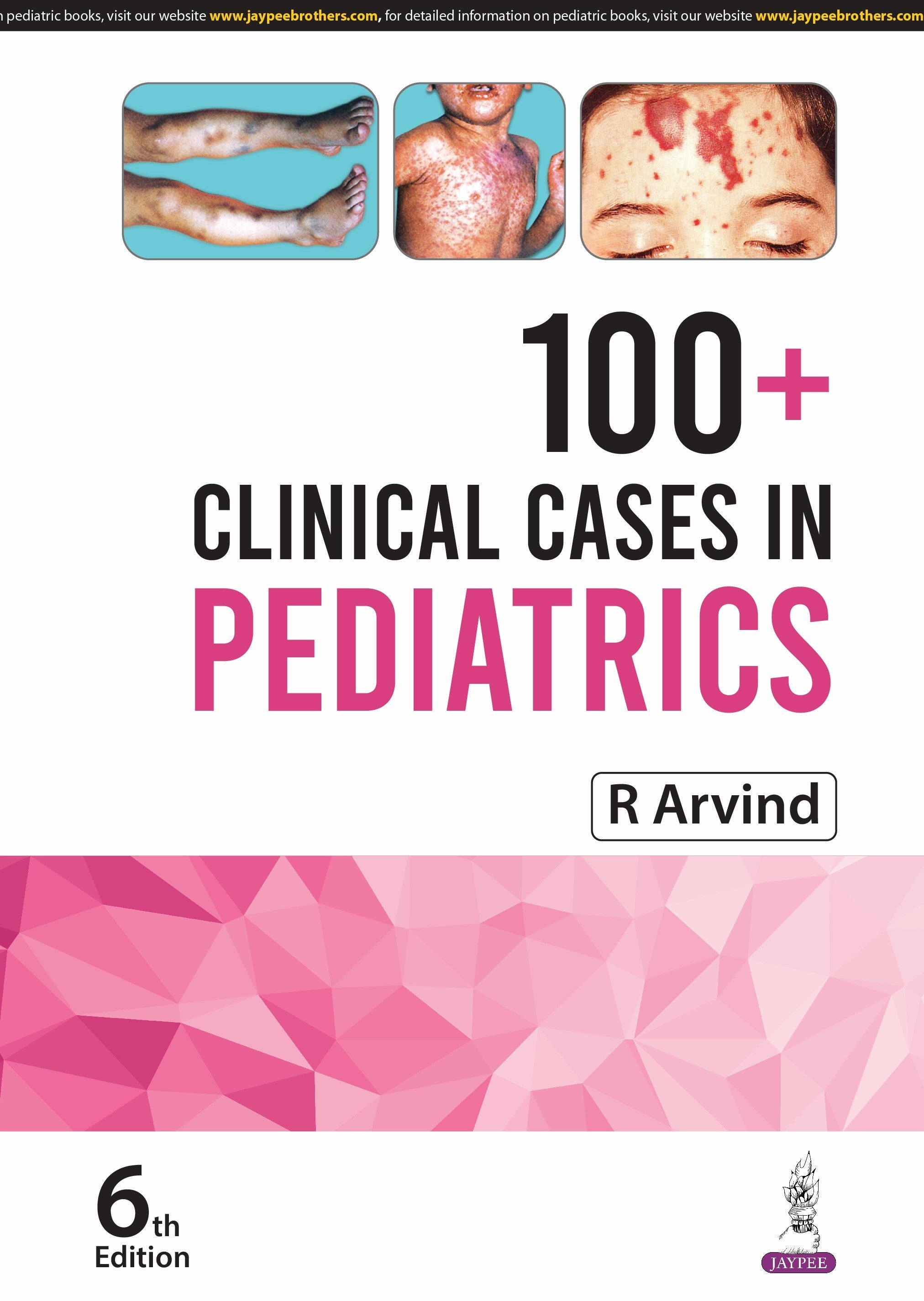 100+ CLINICAL CASES IN PEDIATRICS