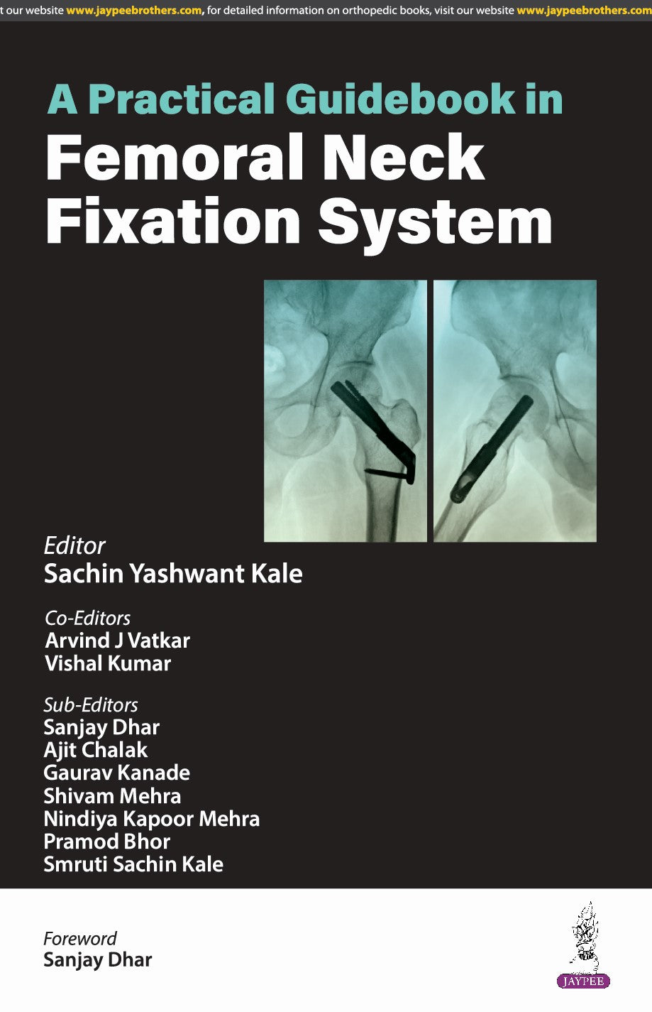 A PRACTICAL GUIDEBOOK IN FEMORAL NECK FIXATION SYSTEM