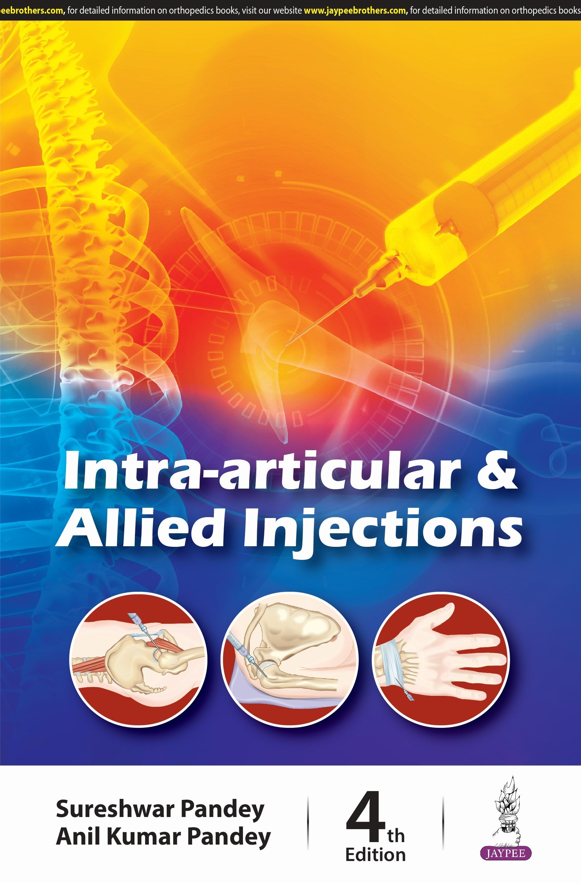 INTRA-ARTICULAR & ALLIED INJECTIONS