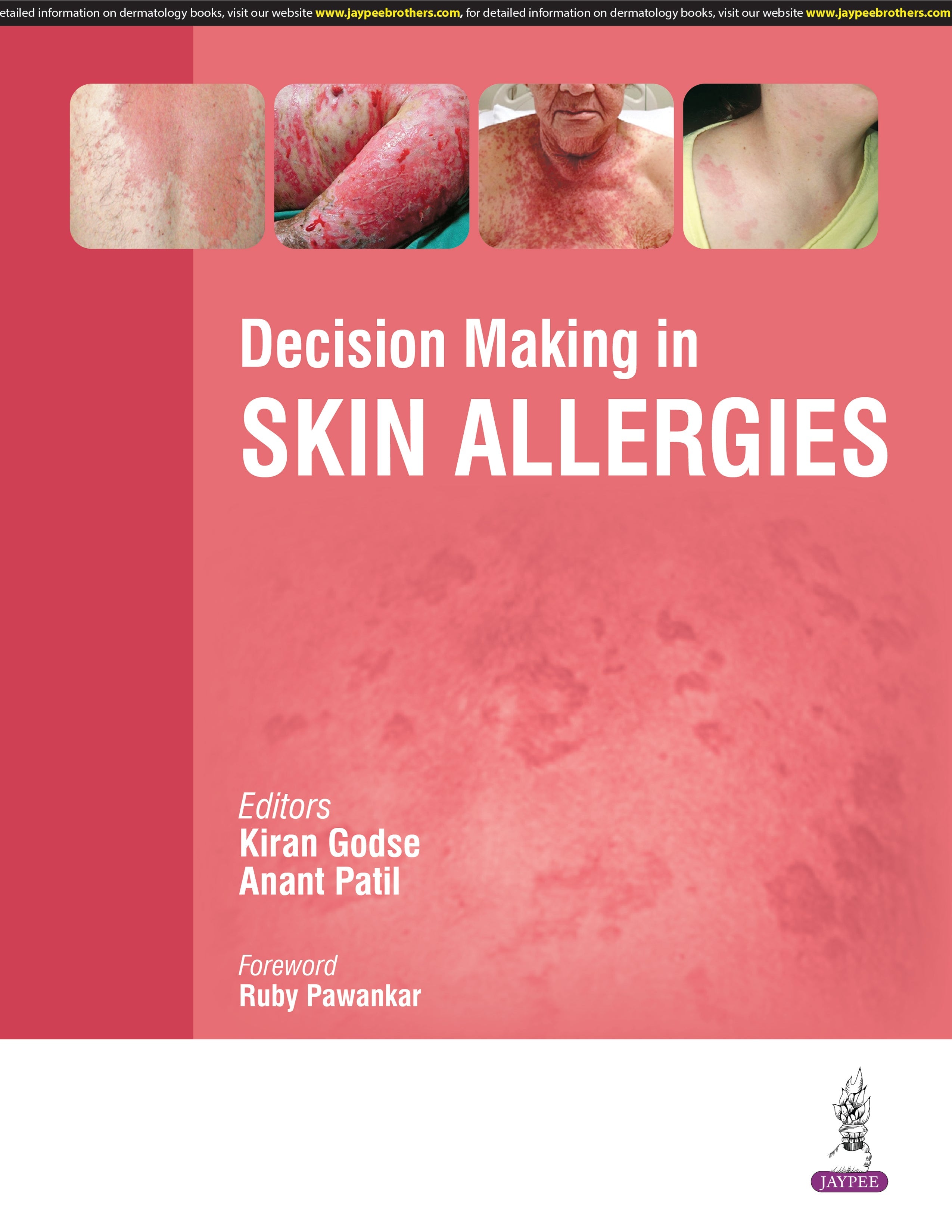 DECISION MAKING IN SKIN ALLERGIES