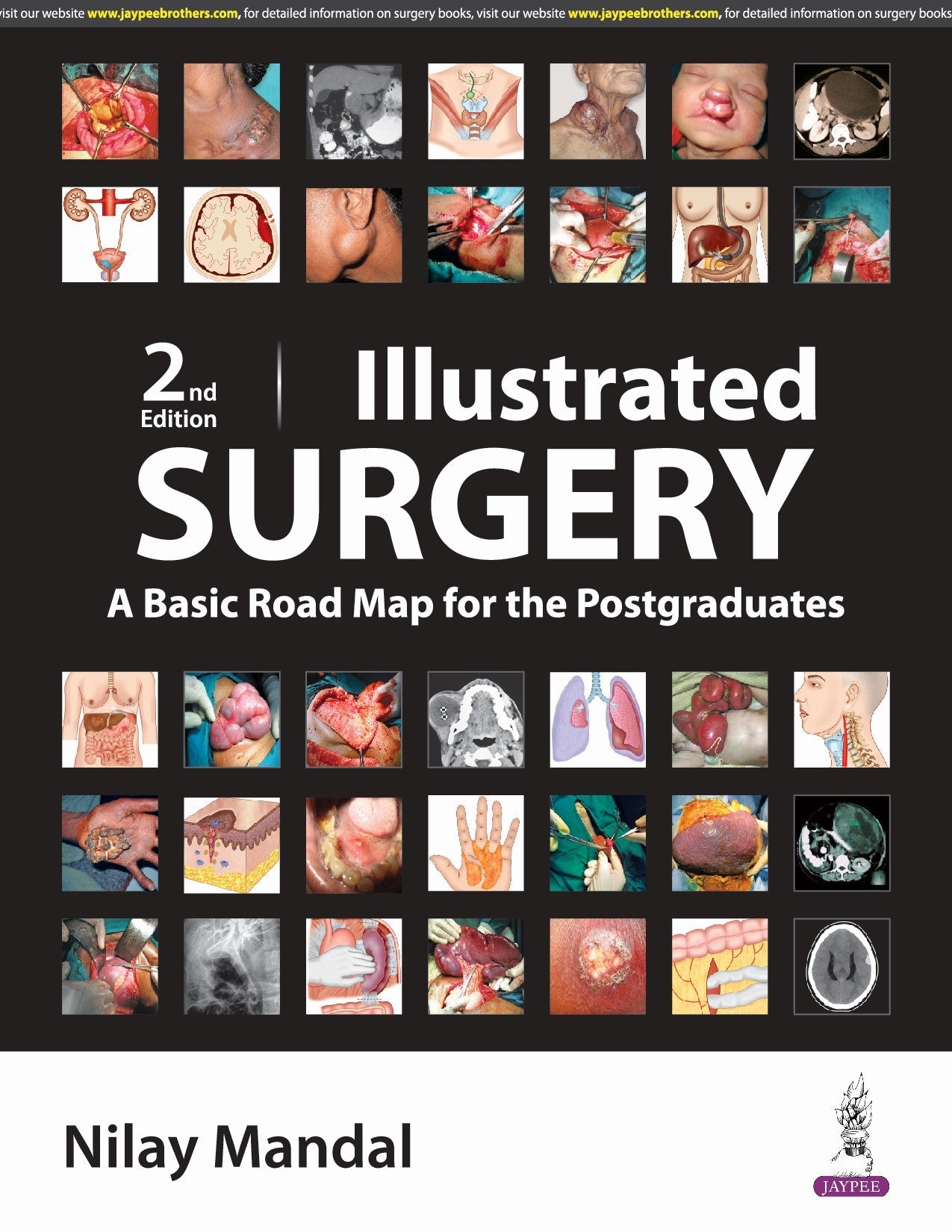 ILLUSTRATED SURGERY A BASIC ROAD MAP FOR THE POSTGRADUATES