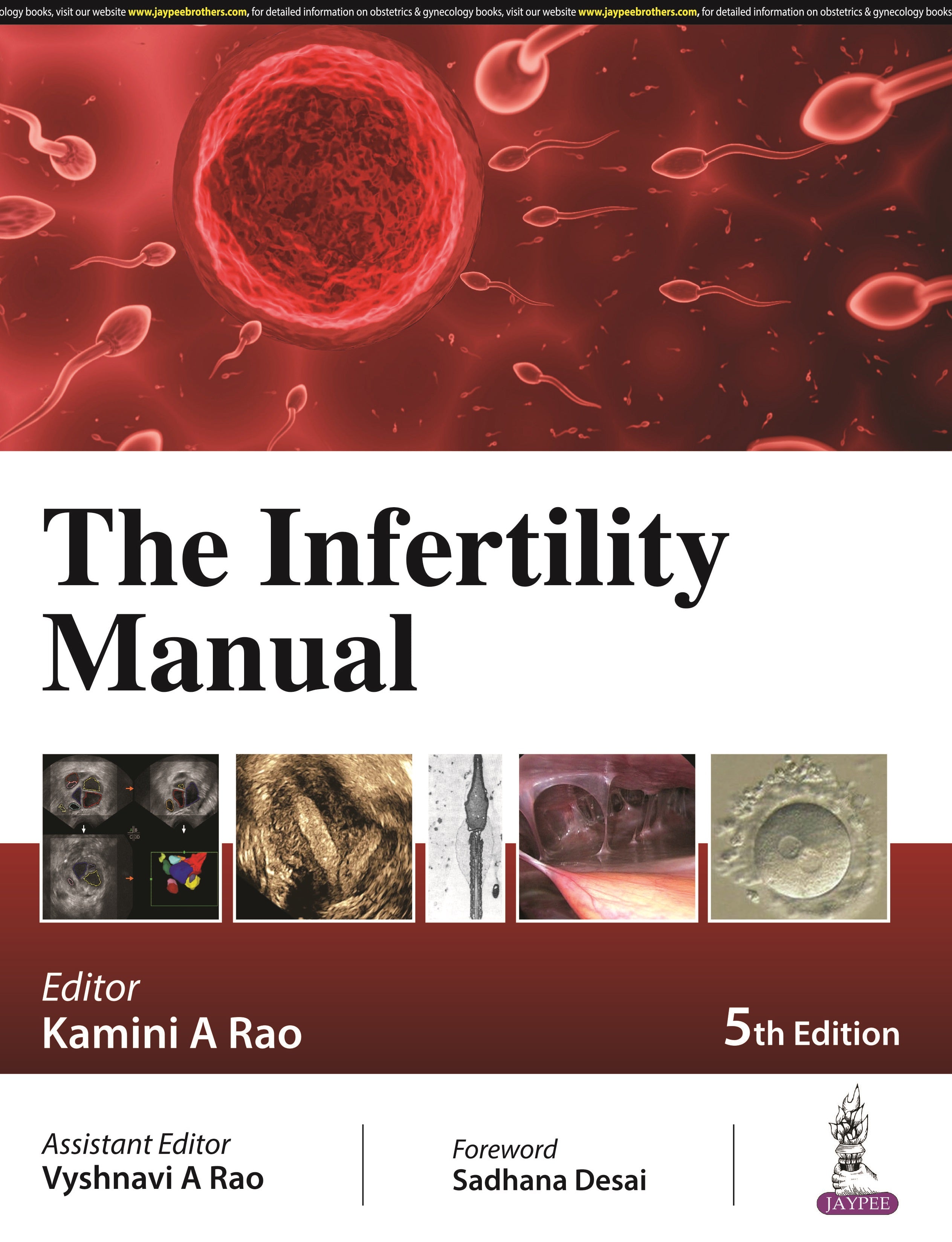 THE INFERTILITY MANUAL